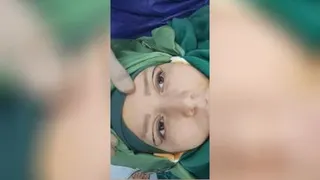 مارک و نقاشی بلفاروپلاستی
