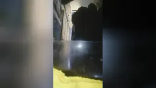 آفتاب سوختگی