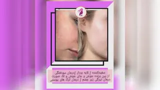مجیک کرم