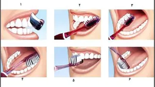 آموزش صحیح مسواک زدن