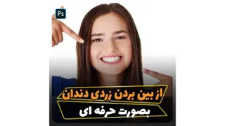 آموزش ازبین بردن زردی دندان