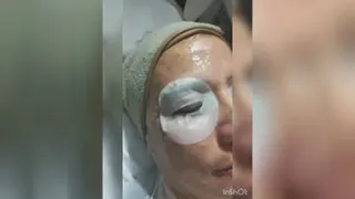 فشیال پوست توسط فریبا نعیمی