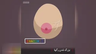 12 نشانه که به تشخیص هر چه زودتر سرطان سینه کمک میکنند (☝️)