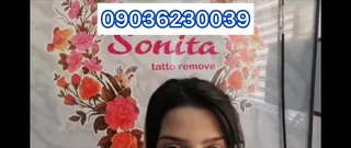 بهترین مرکز لیزر تاتو در تبریز