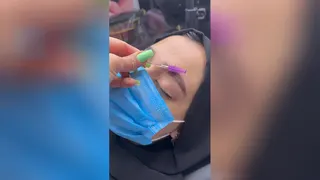 خدمات شیدینگ لب در تهران