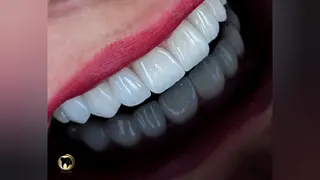 دندانپزشکی در تهرانپارس 09191110339
