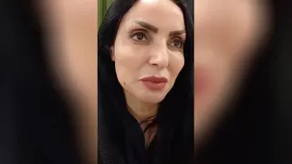 جوانسازی منحصر بفرد با فیلر pcl حاوی سلولهای بنیادی در اصفهان