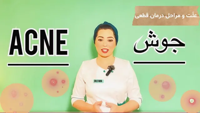 راهنمای جامع درمان پوست چرب و جوشدار: چگونه به طور قطعی جوش صورت و آکنه را درمان کنیم؟