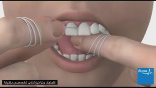 روش کشیدن نخ دندان 1