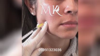 مرکز بوتاکس کرج