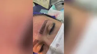 بهترین کاشت مو شیراز
