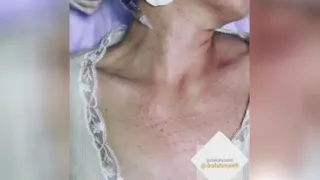 با تزریق این دارو دیگر نگران روند پیری نشو