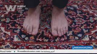 نرمش پای دیابتی در منزل