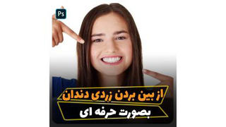 آموزش ازبین بردن زردی دندان