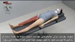 پیوند زدن پوست