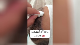مرحله آخر