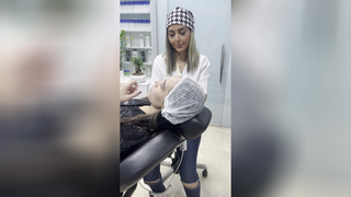 مزونیدلینگ جلسه دوم جهت درمان منافذ باز
