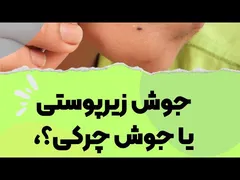 تفاوت بین جوش‌های زیرپوستی و جوش‌های چرکی چیست؟
