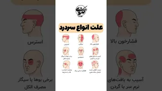 چرا سردرد می‌گیریم؟ آشنایی با انواع و علل سردرد