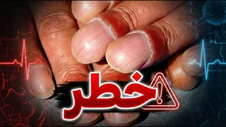ناخن‌ها، کلید سلامتی شما!