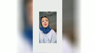 متخصص لثه و ایمپلنت_گرگان_دکترآیدامیرزائی