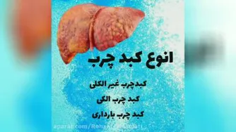 درمان کبد چرب مرگ خاموش