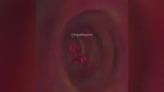 یا من اسمه دواء وذکره شفاء😘😘خواص هسته خرما 😇😇😇😇هرکی نبینه ضرر کرده 😋😋😋