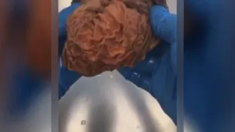 معده انسان