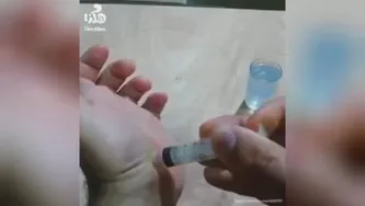 در آوردن خورده شیشه و چوب از دست به راحتی