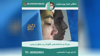 بهترین جراح بینی در تهران_نمونه جراحی بینی از دکتر لعیا یوسفیان