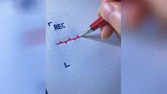 ضربان قلبش❤️😍