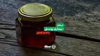 درمان بیماریهای پوستی با عسل طبیعی
