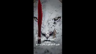 زخم رو دوست دارم....
