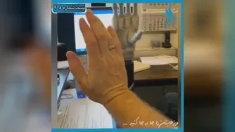 ساخت دست مصنوعی