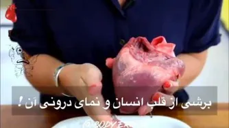 برش قلب انسان