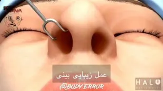 عمل زیبایی بینی