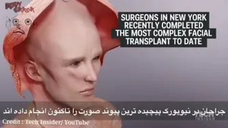 پیوند صورت