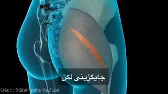 جایگزینی لگن