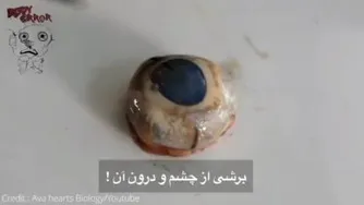 برشی از چشم