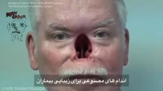 اعضا مصنوعی