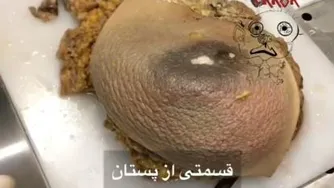 قسمتی از پستان