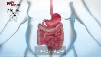 عمل اسلیو معده