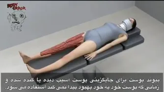 پیوند زدن پوست