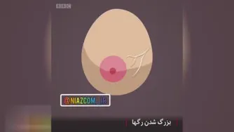 12 نشانه که به تشخیص هر چه زودتر سرطان سینه کمک میکنند (☝️)