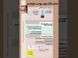 چطور تیرگی دور چشم‌ها را درمان کنیم؟