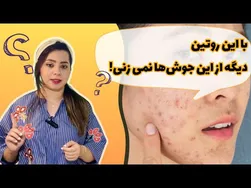 راهکارهای درمان جوش زیرپوستی سفت و دردناک | روش‌های حرفه‌ای مراقبت از پوست با توجه به تغییرات هورمونی