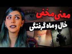 کشف رازهای مرموز خال و لکه‌های مادرزادی | معنی و نشانه‌ها