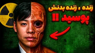 رادیواکتیوترین مرد تاریخ | رموزی از زندگی در حال پوسیدگی