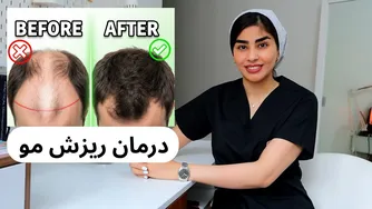 آیا ماینوکسیدیل برای همه مناسب است؟ پاسخ علمی را ببینید!