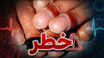 ناخن‌ها، کلید سلامتی شما!